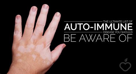 The Ultimate List Of Auto Immune Disease You Should Be