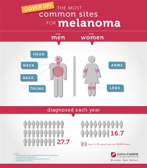 What Are The Most Common Sites For Melanoma Infographic Dana Farber Cancer Institute