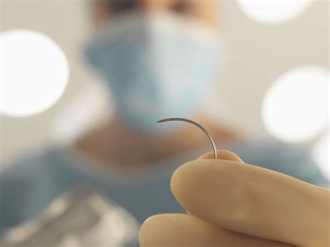 Benefits Of Dissolvable Stitches And Caring For Them