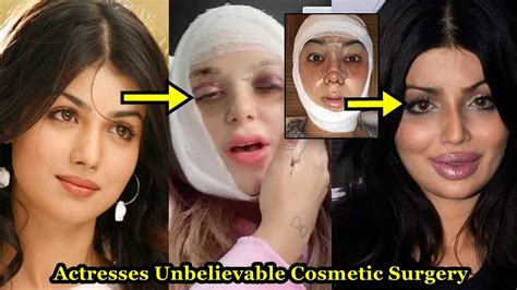 Top Bollywood Actresses Who Looks Horrible After Plastic Surgery You