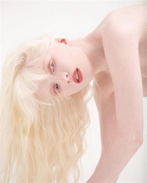 Naked Hot Albino Women Telegraph