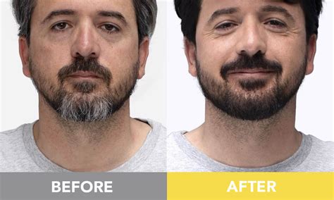 Cleverman Best Rated Beard Dye For Men Customized Reusable Works