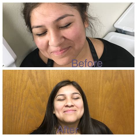 Facial Before And After She Looks Super Fresh And Clean Facial