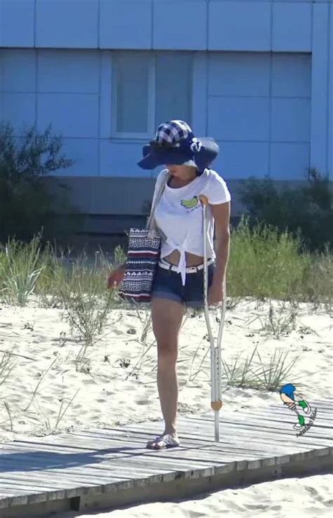 Amputee Legs Stumps And Prostheses — An Onelegged Girl On One Crutch