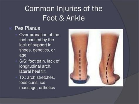 Ppt The Foot Ankle And Lower Leg Injuries Powerpoint Presentation Id