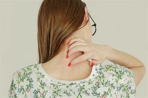 Close Up View Of Woman Scratching Her Neck Stock Photo Download Image