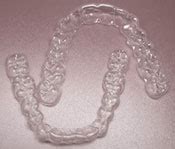 So if you want to avoid the use of chemical based solutions, you certainly. Essix™ Retainer (Clear Plastic Retainer) | Komoroski ...