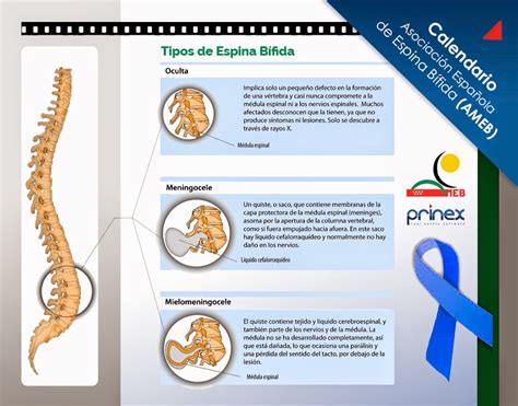 Numerología Vital Del Autoconocimiento Nva Avance La Espina Bifida