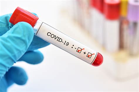 Pandemic policy must include defining and measuring what we mean by mild infection. False Negative: COVID-19 Testing's Catch-22 | MedPage Today