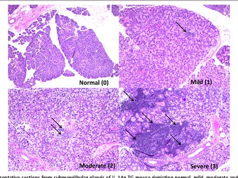 Temporal Histological Changes In Lacrimal And Major Salivary Glands In Mouse Models Of Sjogrens