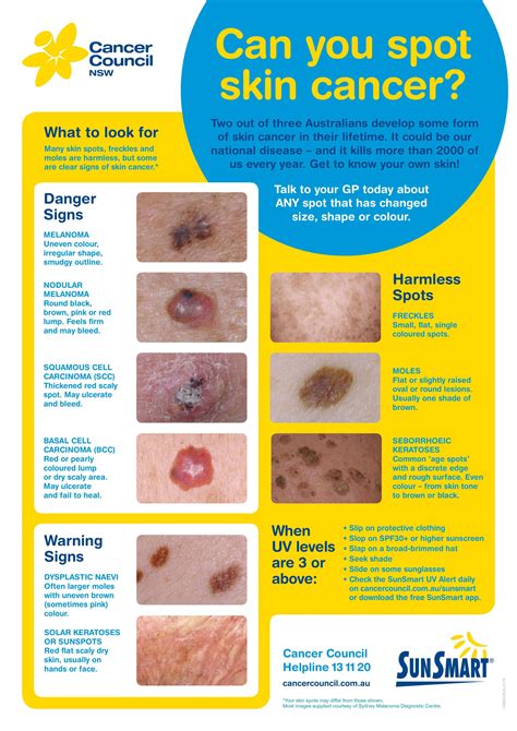 Skin Cancer Checks In Dural Sydney And Australia Dfmp