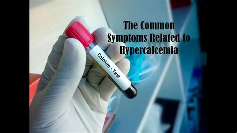 The Common Symptoms Related To Hypercalcemia Youtube