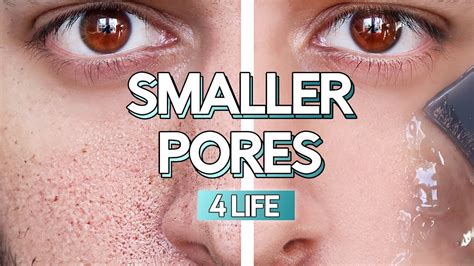Prevent Enlarged Pores Forever With These Simple Steps Mens Oily