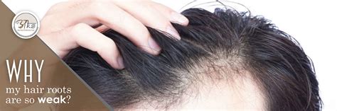 Discover 84 Hair Fall From Roots Best Ineteachers