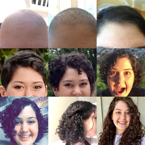 Post Chemo Curly Hair Growth Curlyhair