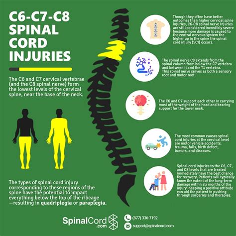 Cervical Spine C6 C7 C8 Vertebrae Spinal Cord Injury Fracture