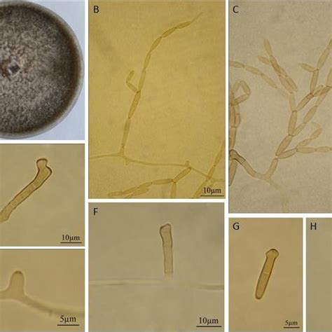 Aureobasidium Microstictum Isolate 1cs1 A Colony On Pda After 7
