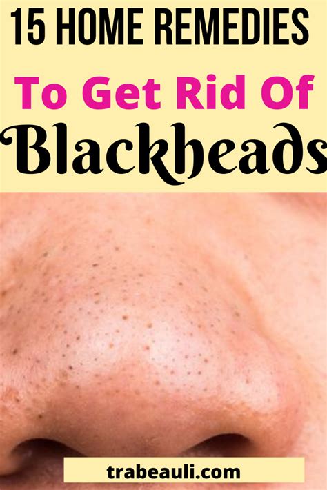 Natural Home Remedies To Get Rid Of Blackheads Is Really Effective Try
