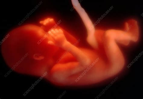 Foetus At 17 Weeks Stock Image P6800192 Science Photo Library