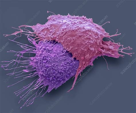 Ovarian Cancer Cells Sem Stock Image F0227986 Science Photo Library