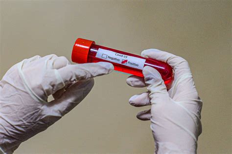 O ministro da saúde do reino unido, matt hancock, anunciou em 14 de dezembro que uma nova variação do coronavírus foi. 1º caso de reinfecção por nova variante do coronavírus é ...