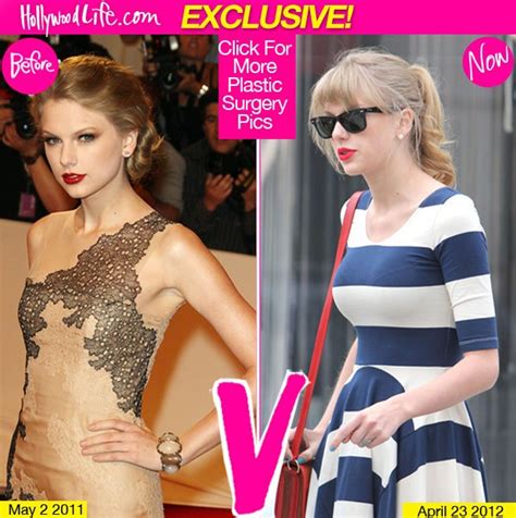 Pics Taylor Swift Breast Implants See The Before And After Pics