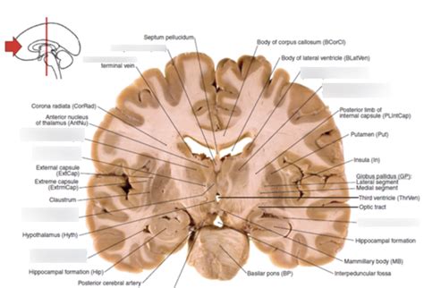 Coronal Cross Section Of Brain 4 Diagram Quizlet