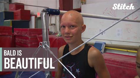 Teen With Alopecia Spreads Message That Bald Is Beautiful