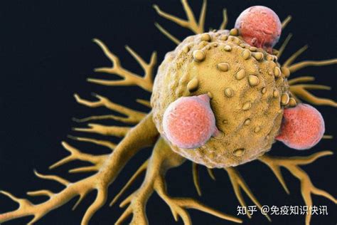 免疫细胞可以攻击胰腺癌肿瘤？科学家：有证据证实可以！ 知乎