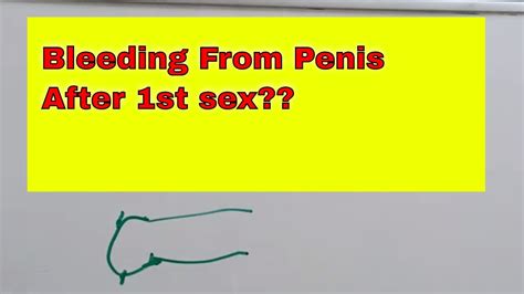 Bleeding From Penis After First Time Sex How To Do Sex Sex First