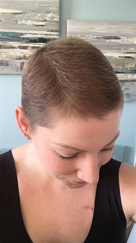 My Tips For Hair Growth Post Chemo Rethink Breast Cancer