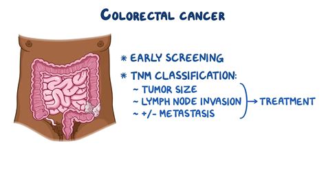 Colorectal Cancer Clinical Sciences Osmosis Video Library
