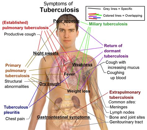 In treatment of mdr/xdr‐tb pym as, et al. Do u know -->> TB , DR-TB , MDR-TB , XDR-TB , TDR-TB - IAS ...