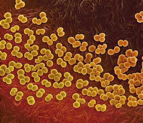 Mrsa Bacteria Photograph By Science Photo Library