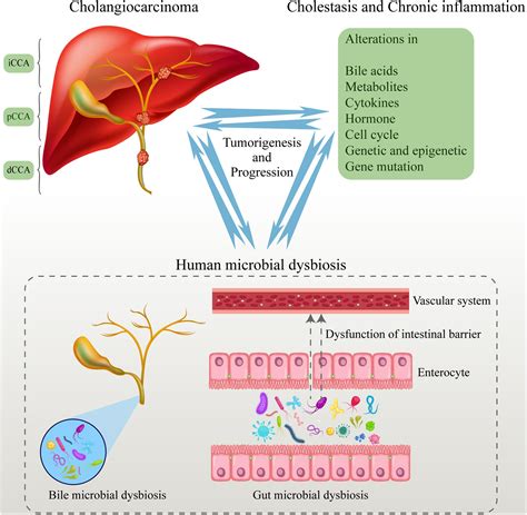 Frontiers Dysbiosis In The Human Microbiome Of Cholangiocarcinoma