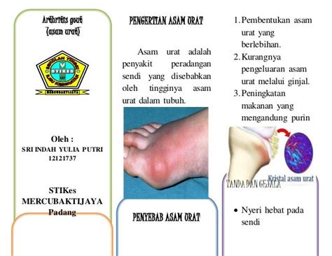 Arthritis Gout Leaflet Indah