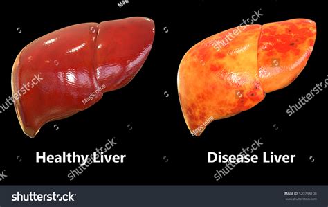Liver structure liver function human liver structure liver anatomy diagram of liver… through liver diagram we can also understand the liver anatomy and liver structure clearly. Human Body Organs Liver Anatomy 3d Stock Illustration ...