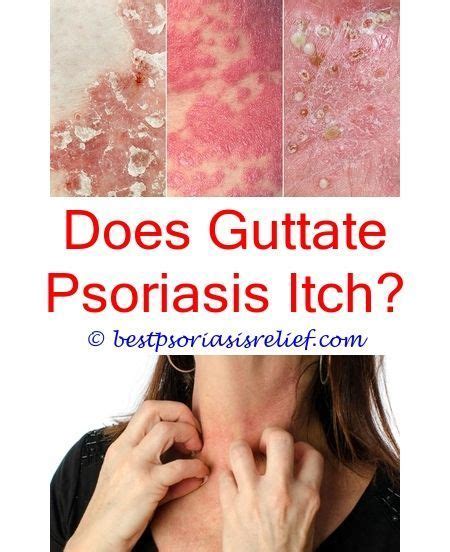 Psoriasisrash Male Genital Psoriasis Pictures Psoriasis Under Arms