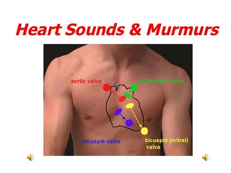 heart sounds and murmurs by sherry knowles via slideshare medicine notes internal medicine