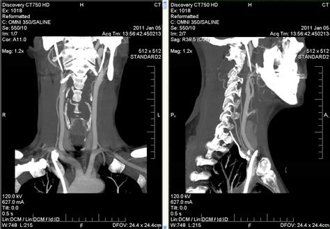 Just Keep Going Neck Mri And Ct Scan Images