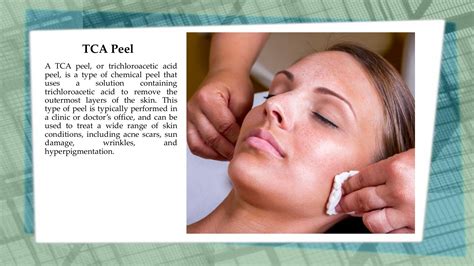 Understanding The Different Types Of Chemical Peels Kathryn Teague