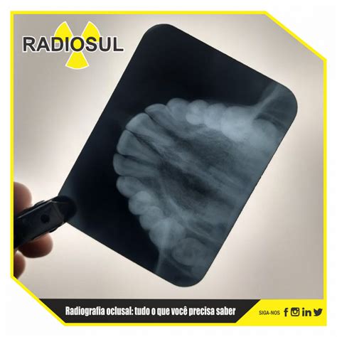 RadioSul Digital Radiografia oclusal tudo o que você precisa saber