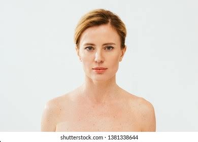 Naked Sick Woman Skin Illness Looking Stock Photo 1381338644 Shutterstock