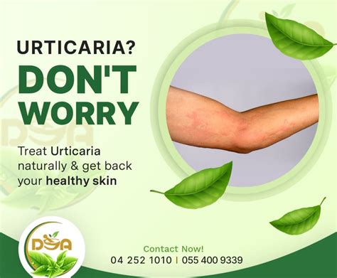 Natural Ayurvedic Treatments For Urticaria Dr Jasnas Clinic