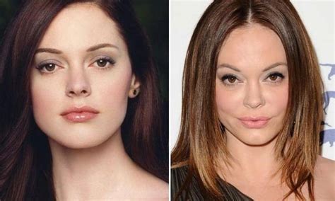 Rose Mcgowan Before And After Plastic Surgery 12 Celebrity Plastic