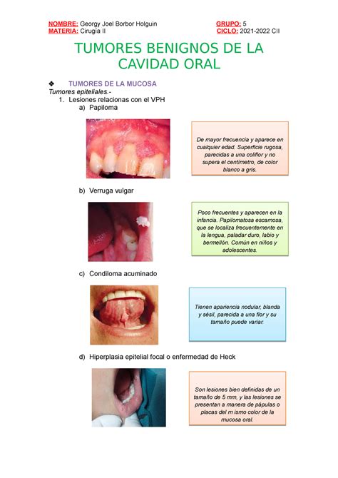 Tumores Benignos De La Cavidad Oral Materia Cirug A Ii Ciclo
