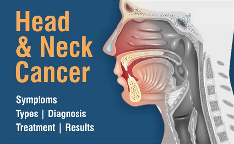 Head And Neck Cancer Symptoms Types And Treatment Dr Ashwani Kumar
