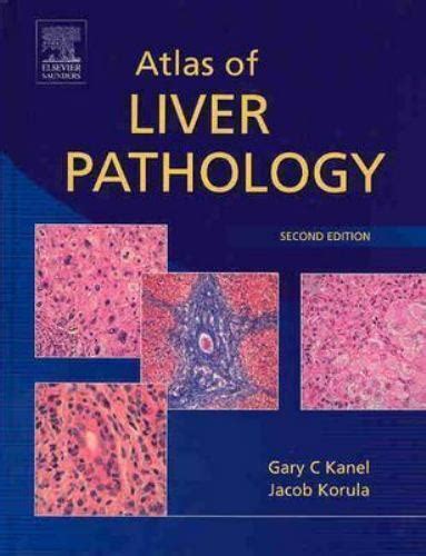 Atlas Of Surgical Pathology Ser Atlas Of Liver Pathology By Jacob