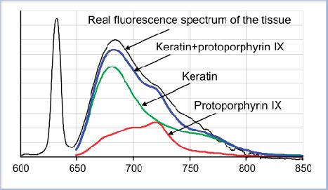 Iterative approximation of the model autofluorescence ...