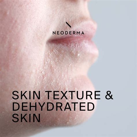 Skin Texture And Dehydrated Skin Neoderma